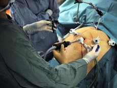 Gastric surgery: Is it really the answer to the UK’s obesity epidemic?