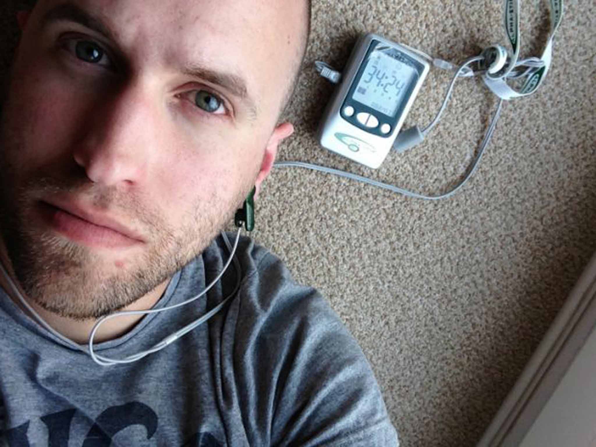 Current thinking: David Bass found Alpha-Stim helped his OCD but his problems with the condition aren't solved