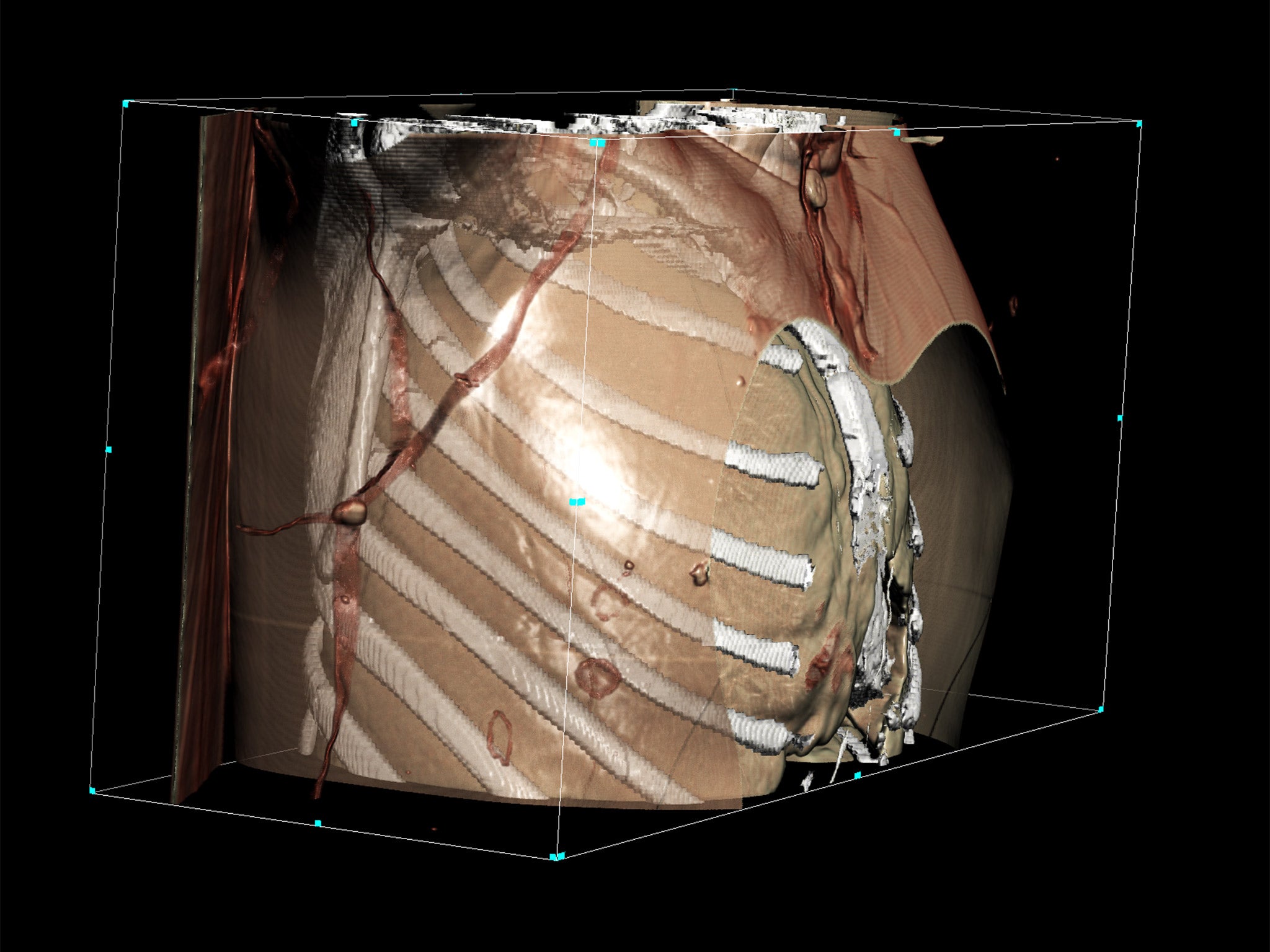 iGene can perform postmortems using detailed digital images