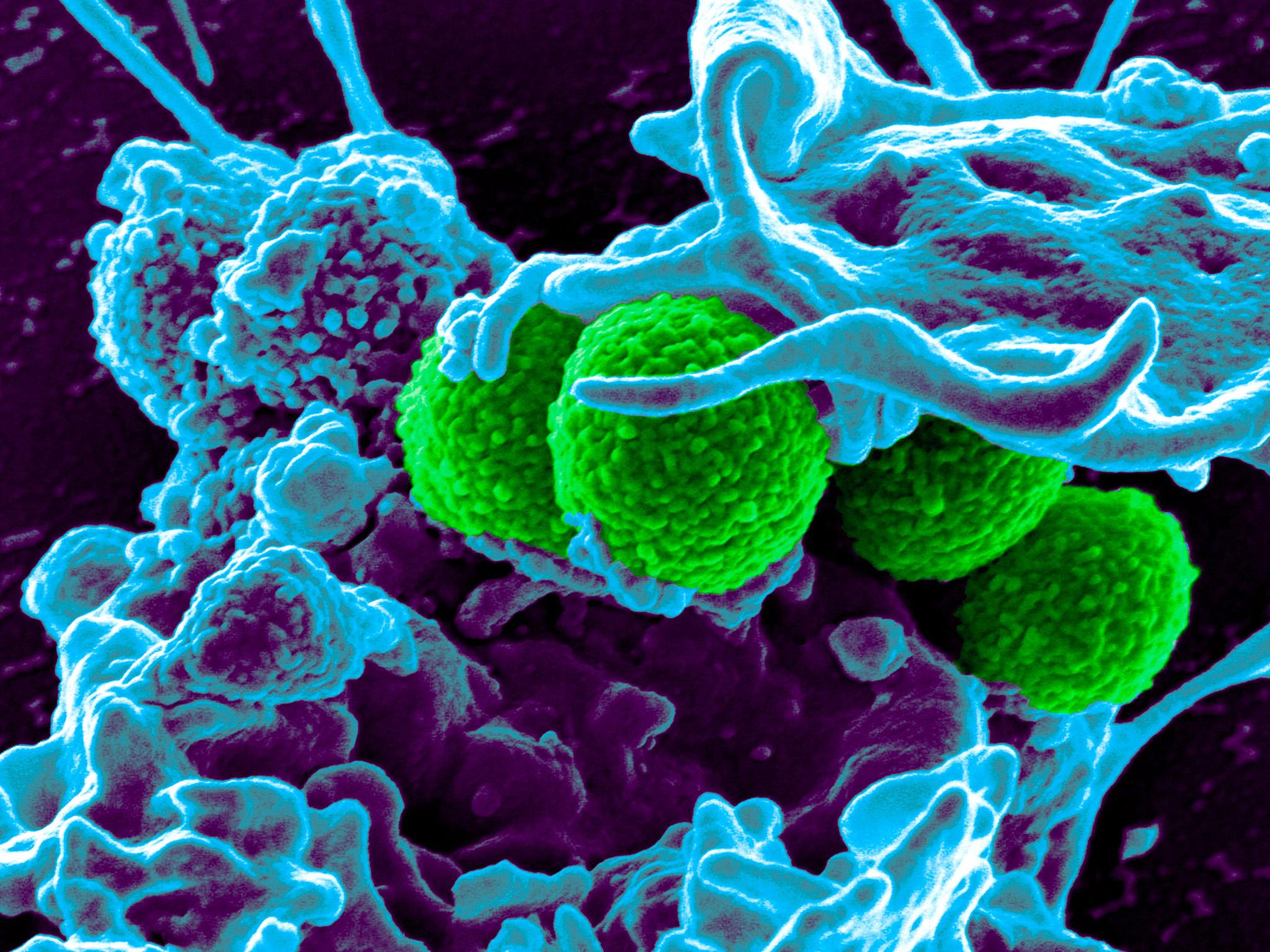 A micrograph showing MRSA bacteria