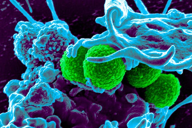 A micrograph showing MRSA bacteria