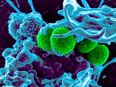 Human-virus hybrid created to kill off antibiotic-resistant superbugs