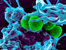 Human-virus hybrid created to kill off antibiotic-resistant MRSA superbug