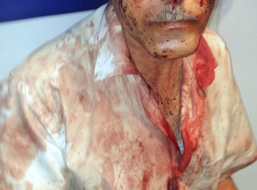 Ilgar Nasibov, a journalist and activist who works for Azerbaijan's Nakchivan Resource Centre, was badly beaten