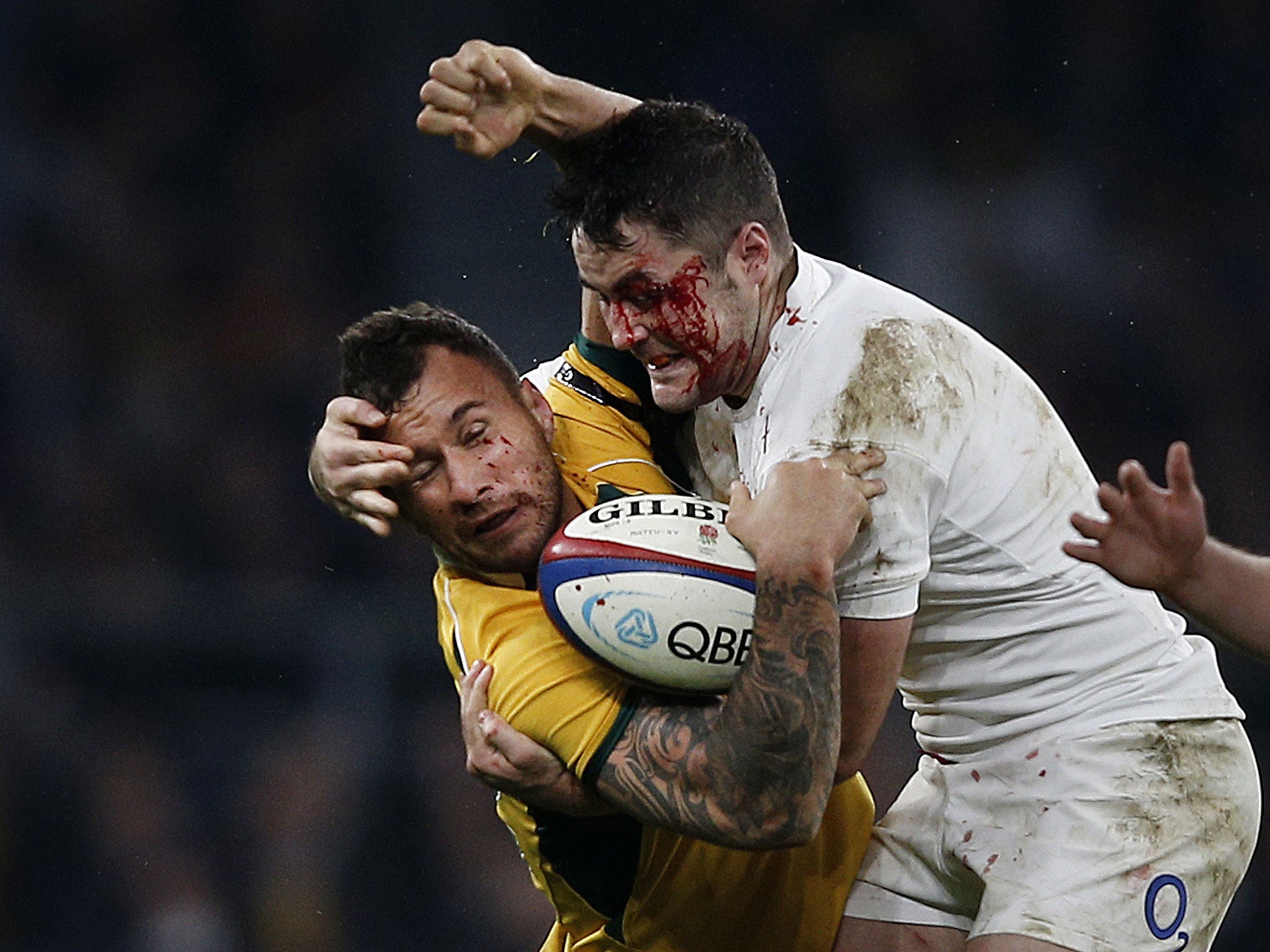 Barritt was left bloodied and bruised from England's win over Australia