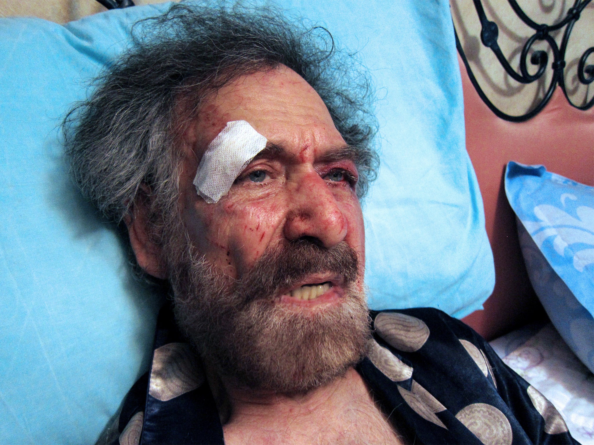 Ferzat was beaten by a gang of what he calls ‘Assad’s thugs’, in 2011 (Getty)