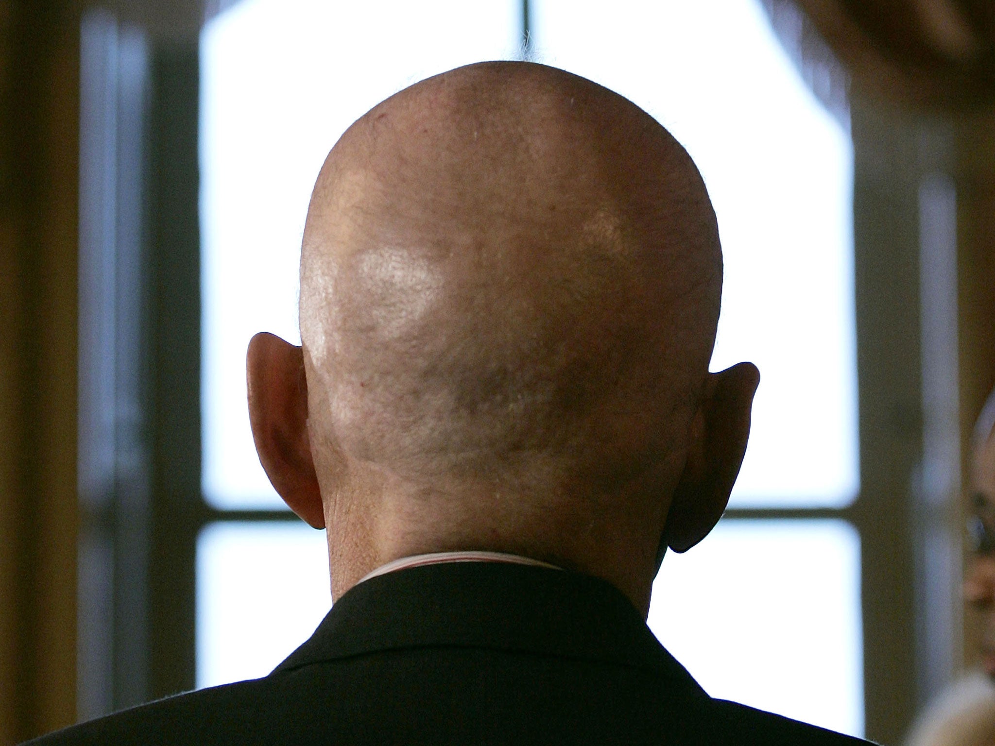 Scientists believe that have found a cure for baldness