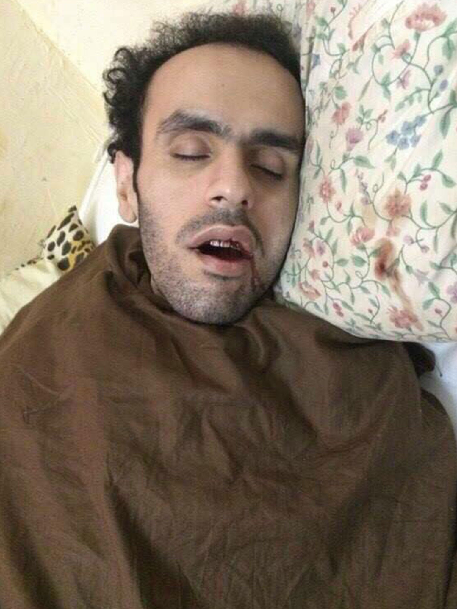 Mohamed Soltan shown bleeding in an Egyptian prison