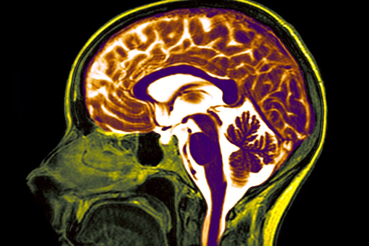 Nano memory cells could let scientists create bionic brains, making ...