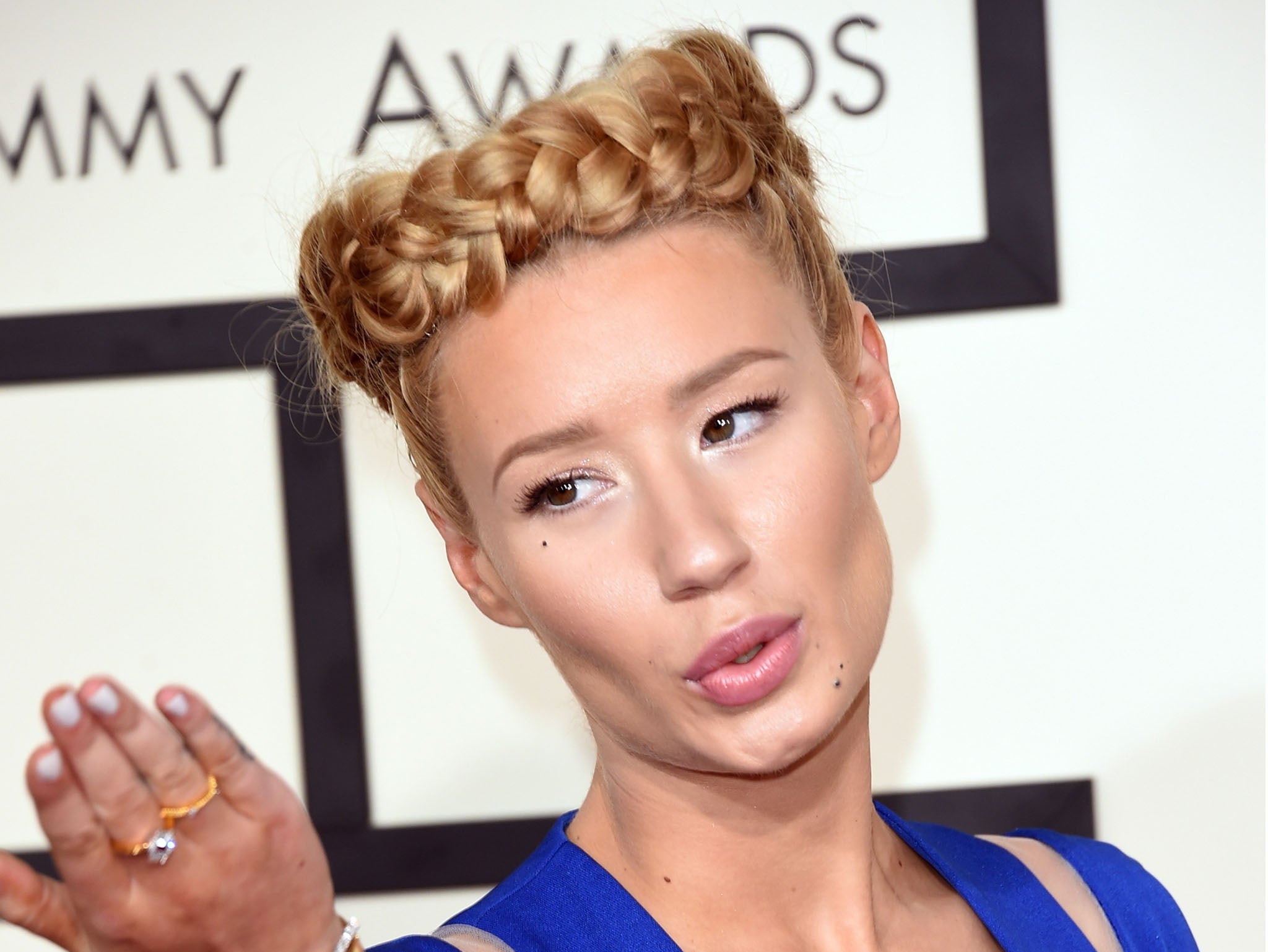 Iggy Azalea has 'finally admitted' to having surgery. We should all feel  ashamed of ourselves for asking | The Independent | The Independent