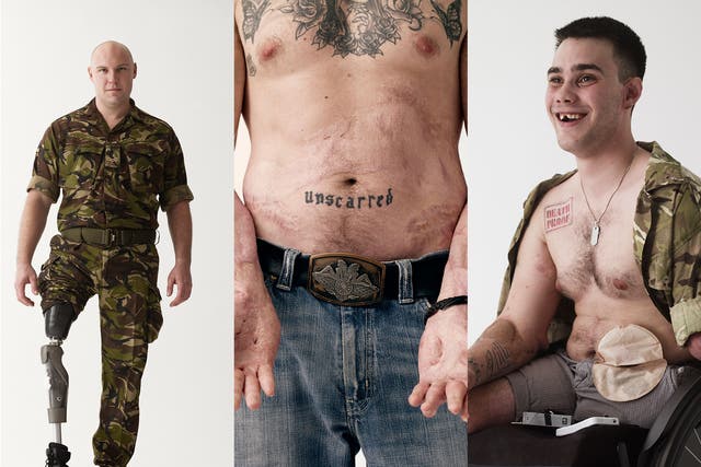 The musician Bryan Adams let us use his photos of wounded veterans as a visual representation of the hardships faced by soldiers both abroad and at home