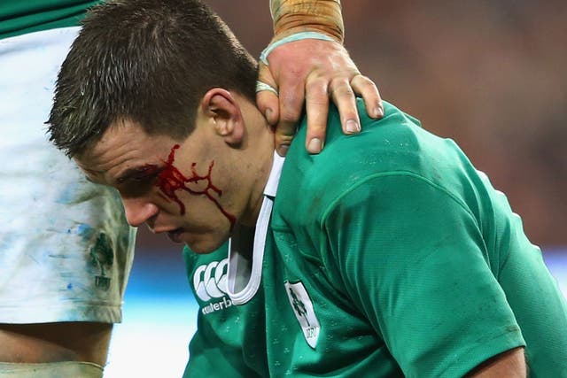 Jonathan Sexton bleeds from a cut during Ireland's 18-11 victory over France