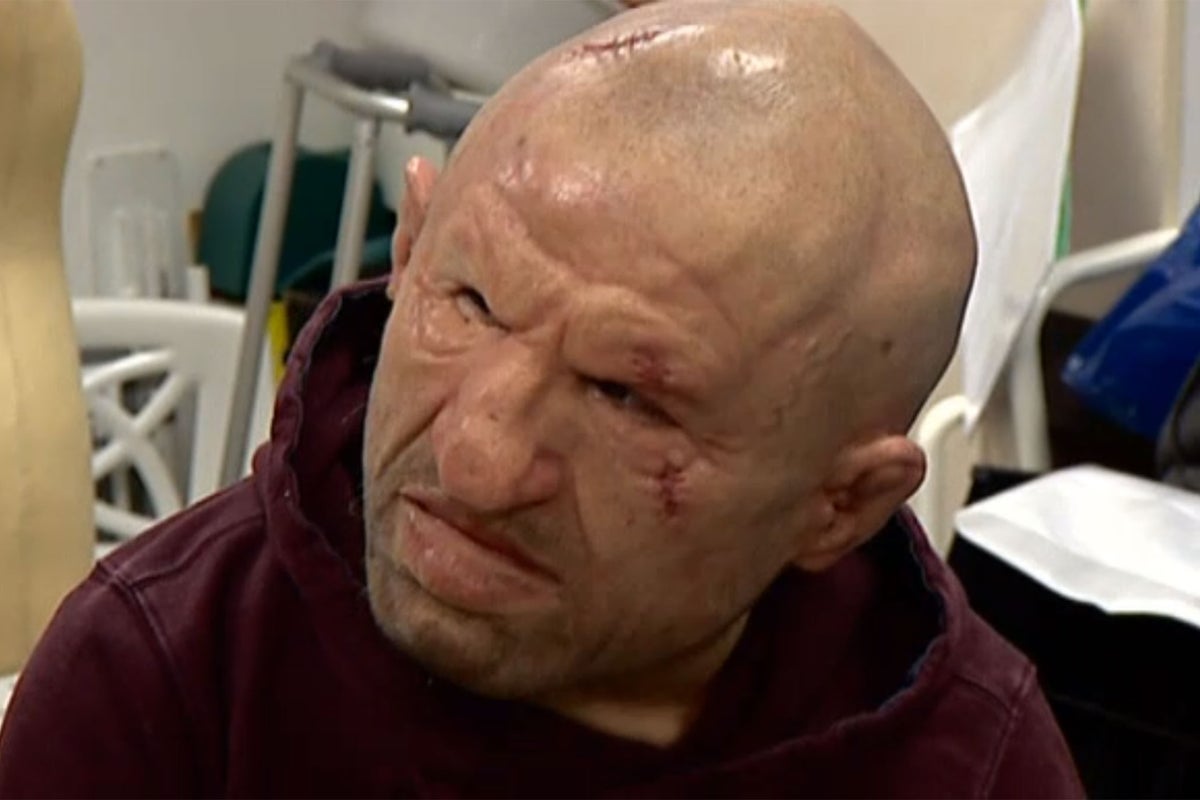Masks used for nurse training scrapped by university after claims they ...