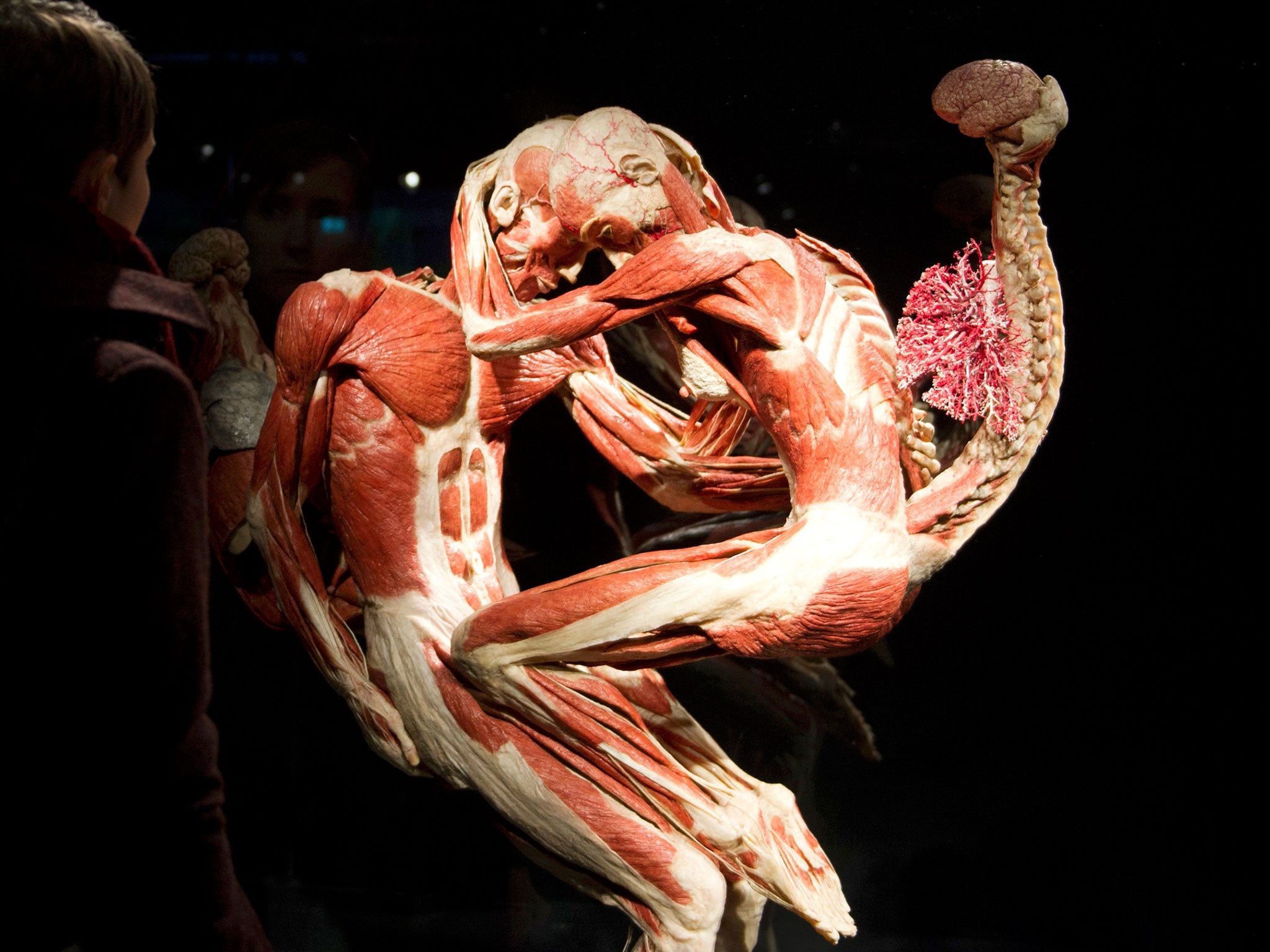 A visitor looks at plastinated human bodies prior to the opening of "Body Worlds" permanent exhibition by German anatomist Gunther von Hagens at the Menschen Musem in Berlin. The controversial permanent exhibition of more than 200 unique plastinates, bodi