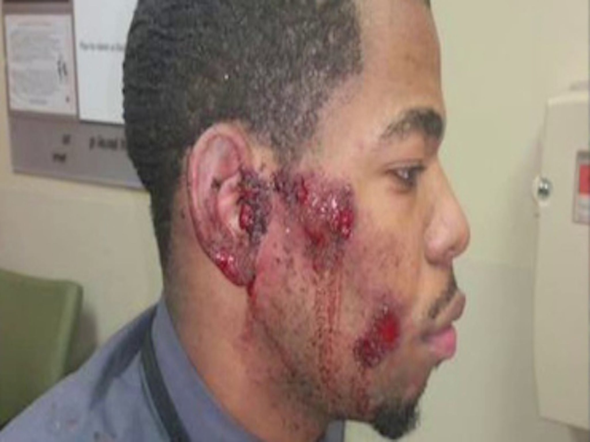 Cortez Bufford is suing St Louis police for allegedly using unnecessary force