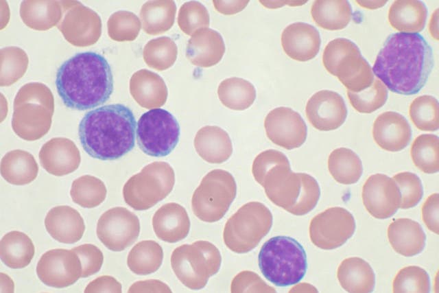 Build-up of genetic mutations closely linked with the emergence of cancer of white blood cells
