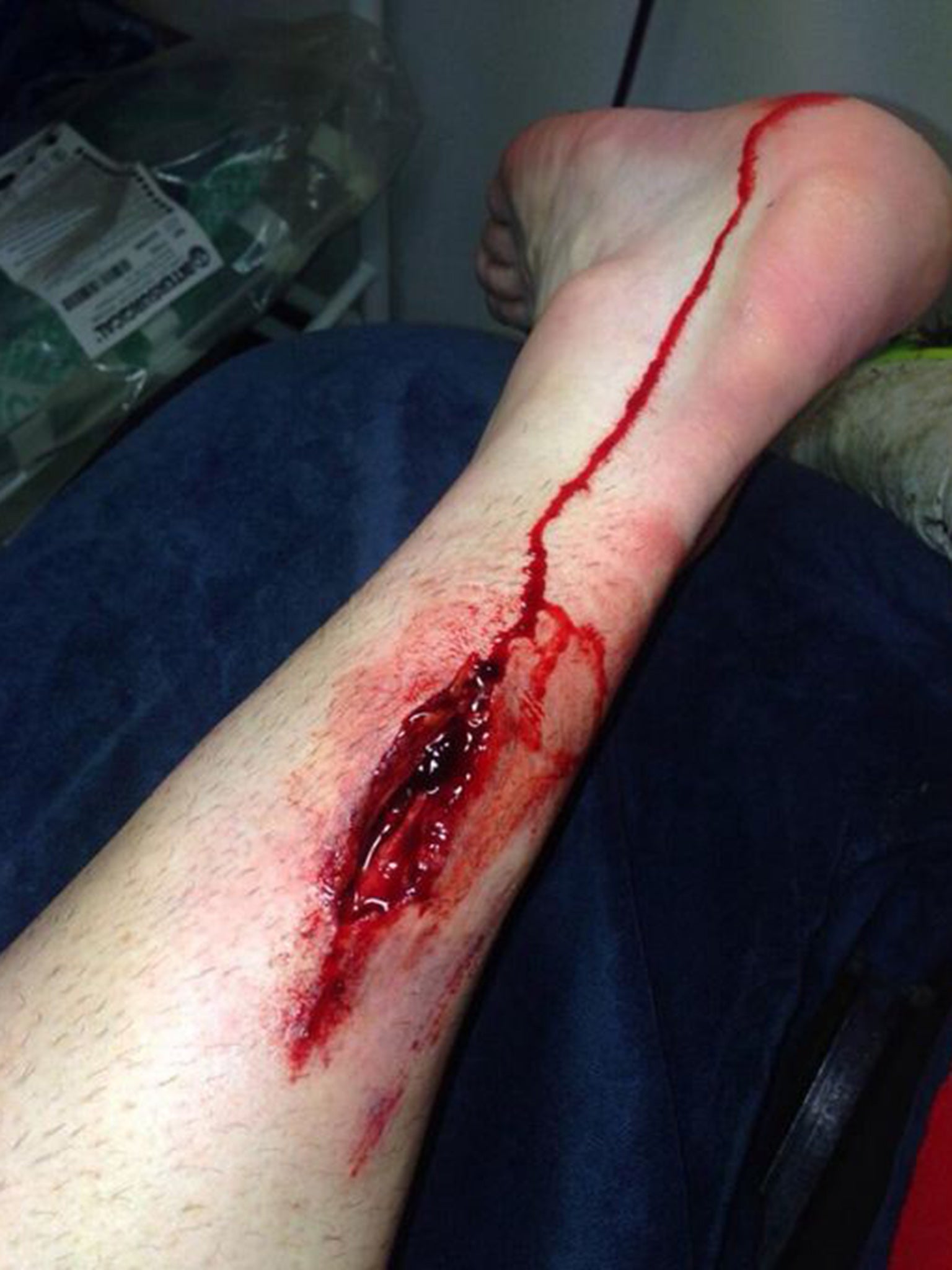 Stephen Ireland's leg after the challenge from Maynor Figueroa that went unpunished