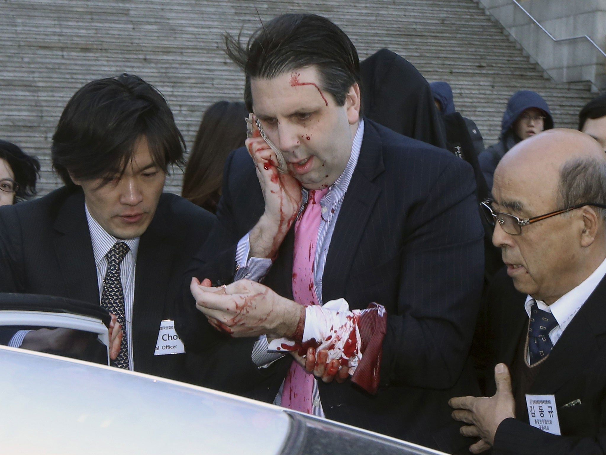 US ambassador to South Korea Mark Lippert leaves after the attack in Seoul