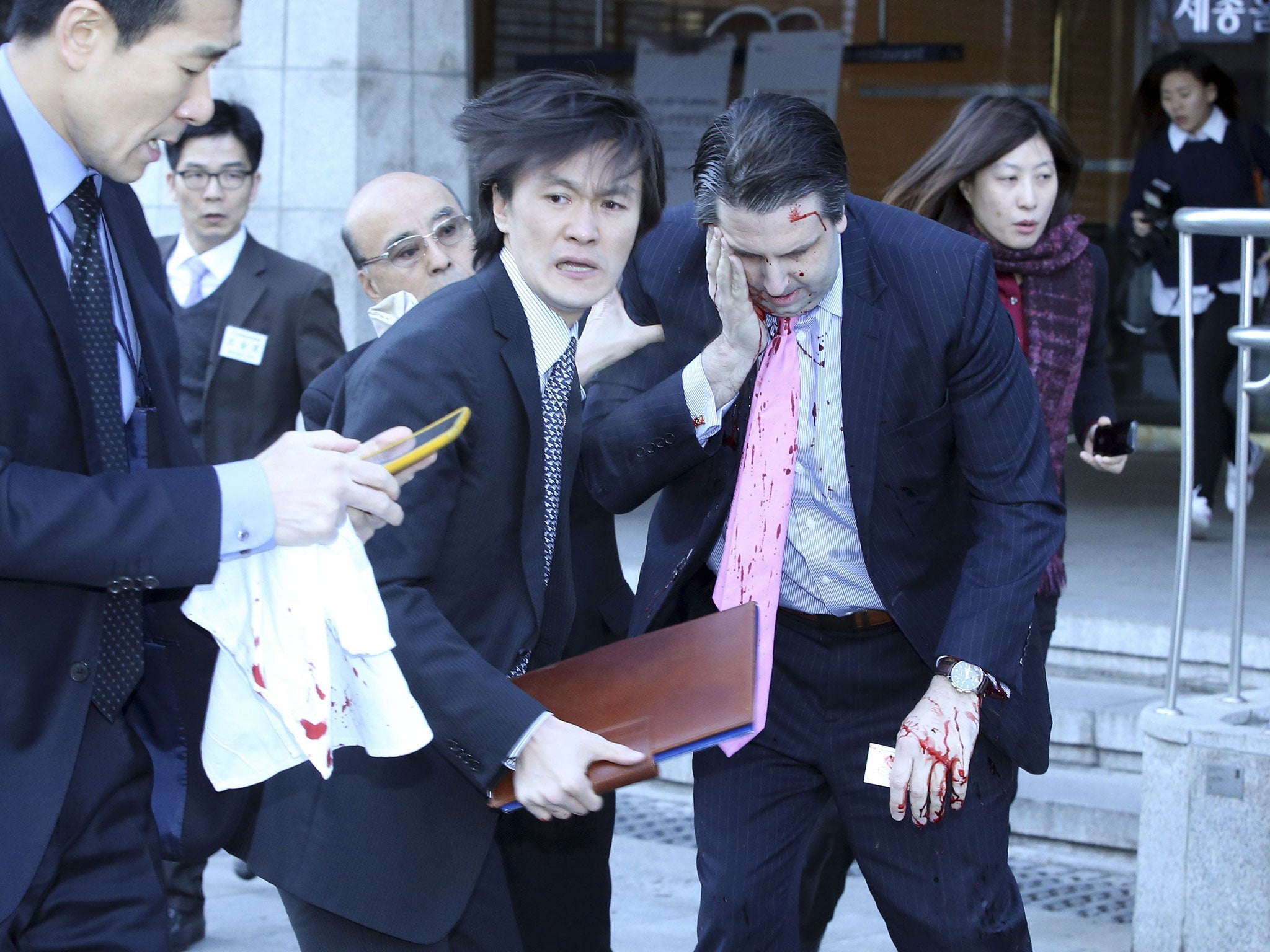 The US ambassador to South Korea Mark Lippert (R) leaves a meeting after he was slashed in the face by a knife-wielding assailant (Reuters)