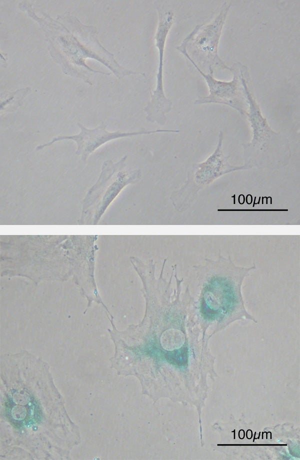 (Top) healthy mouse embryonic fibroblast cells, (bottom) cells after senescence, which speeds up the aging process