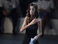 Lizzie Velasquez explains how she copes with online bullying