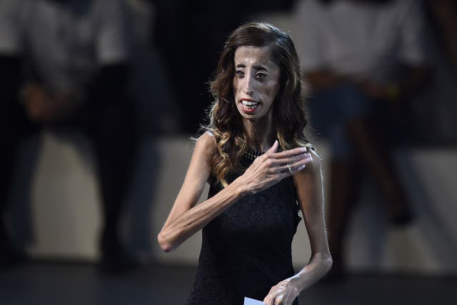 Lizzie Velasquez delivers a speech during a conference at the National Auditorium in Mexico city, on September 5, 2014