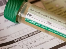 Decision to only test women for chlamydia is ‘disaster’, leading sexual health organisation warns