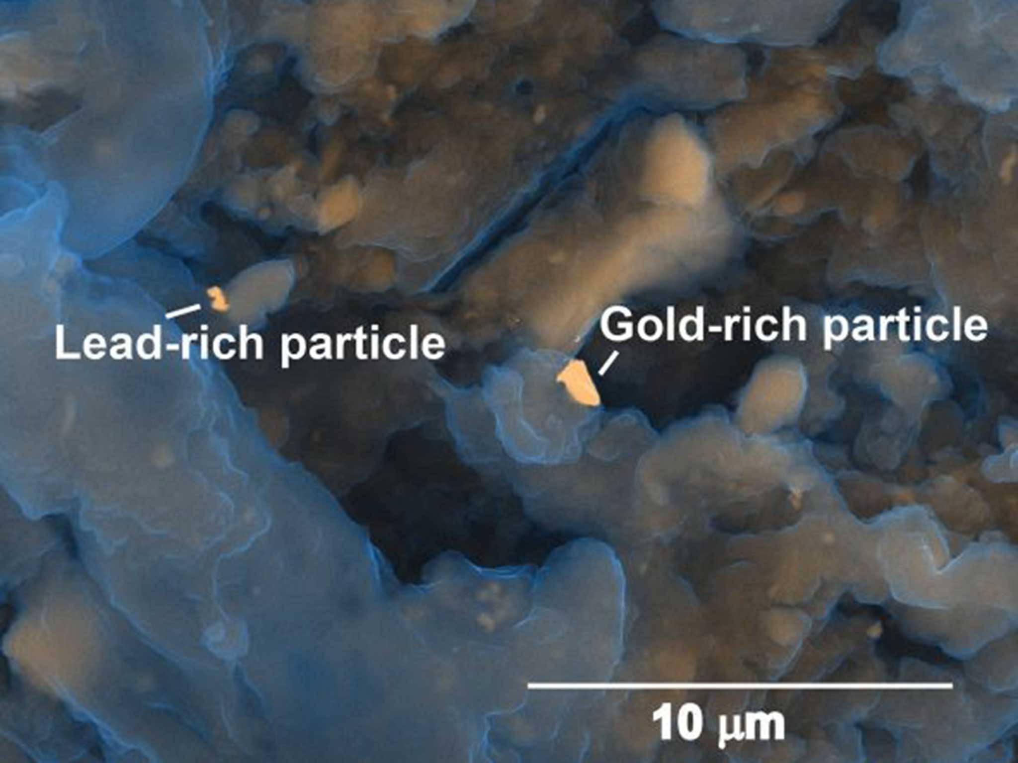 A close up of the microscopic particles found in human waste