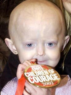 Progeria campaigner dies aged 17