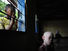 Number of attacks on Albinos in Tanzania on the rise- video