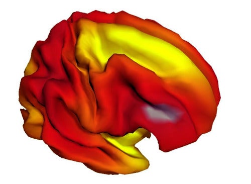 A composite image showing the relationship between brain surface expansion and age in children and young people aged three to 20