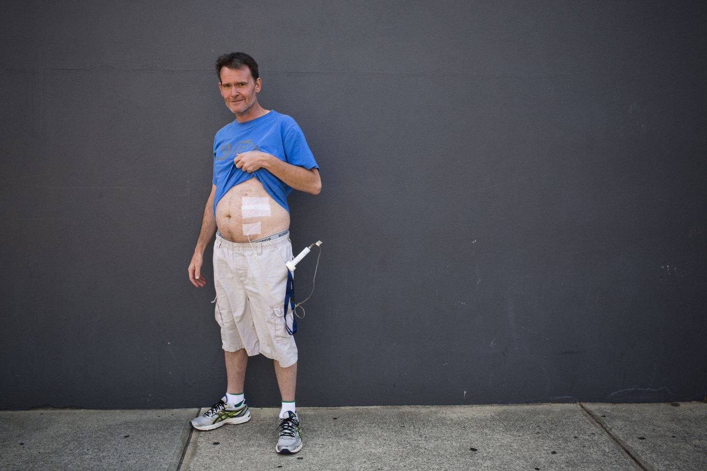 Slow release: a client at the clinic shows his syringe infusion pump (David Maurice Smith/Oculi)