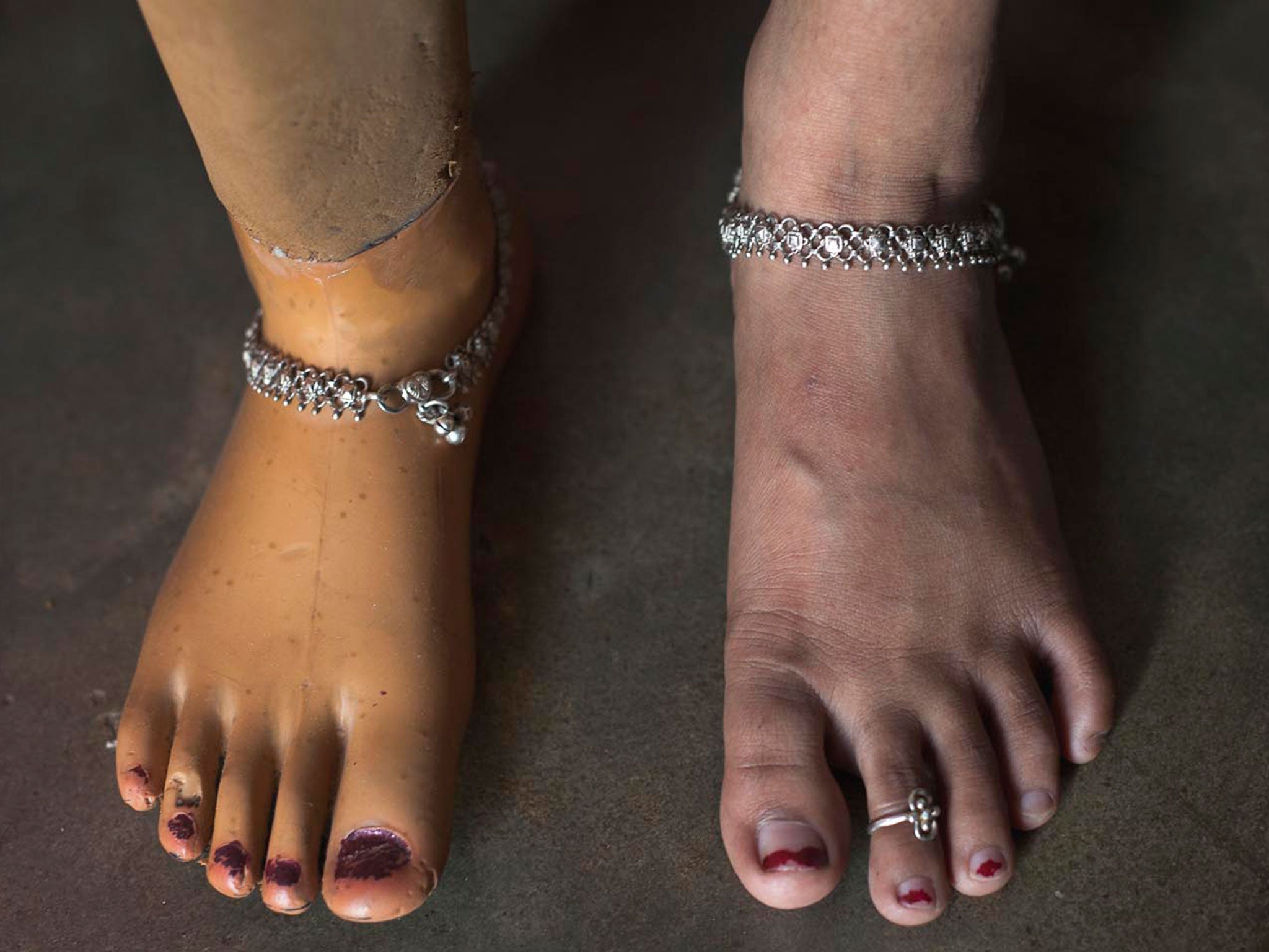 Garment worker Shahinur lost her right leg at the Rana Plaza tragedy at Savar near Dhaka © NashirulIslam