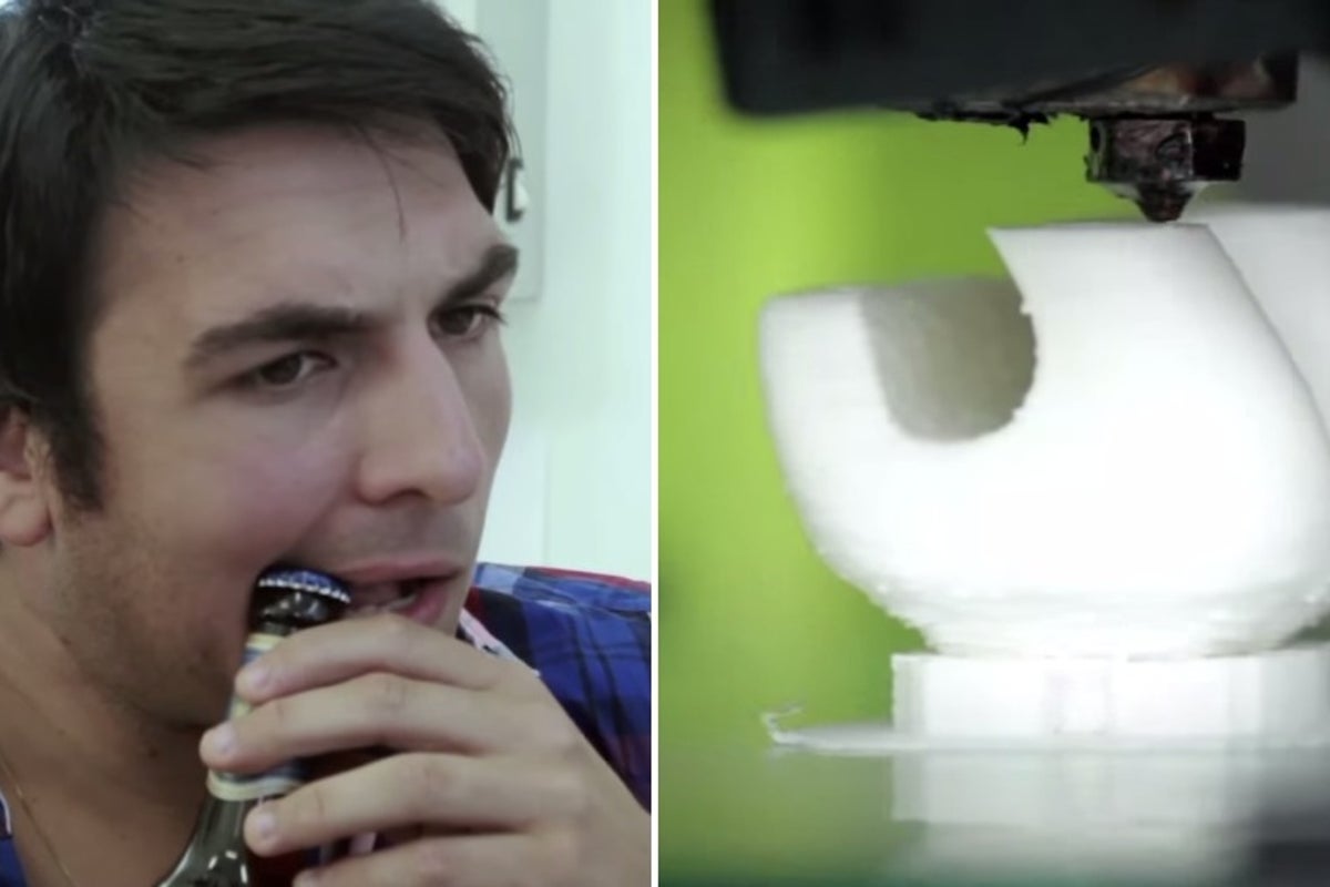 You can now get a tooth that doubles as a beer bottle opener | The ...