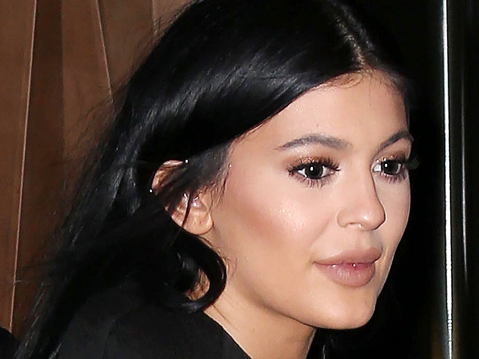 Kylie Jenner, 17, finally admitted to having the non-surgical procedure