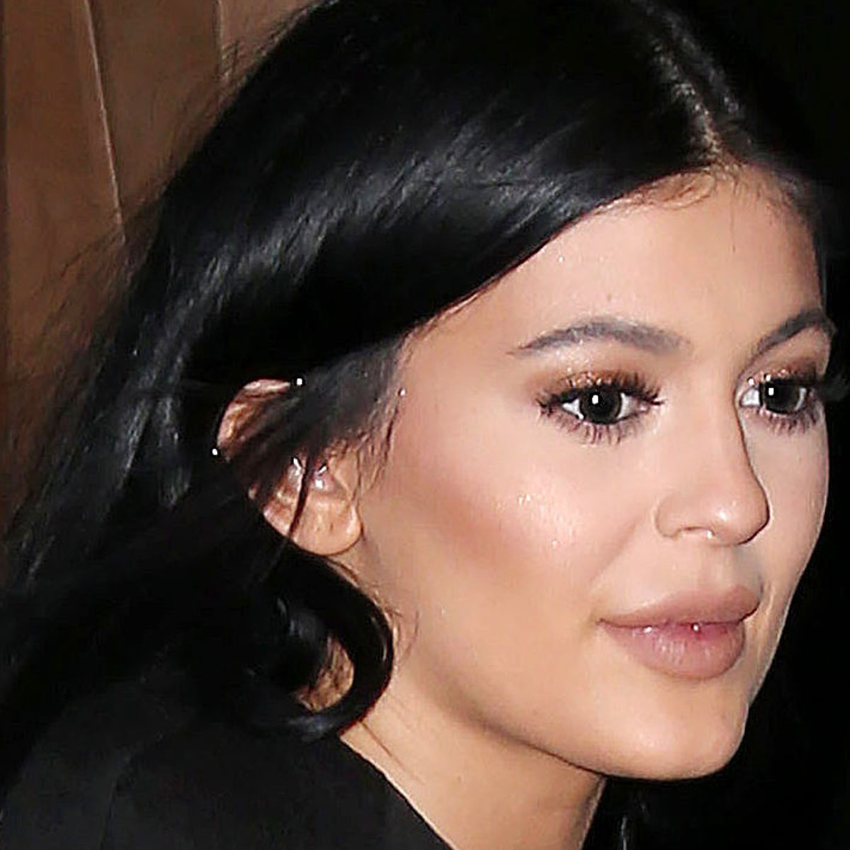 Kylie Jenner Lip Fillers: Experts Explain The Medical And Ethical Minefield  Around Injecting A 17-Year-Old Girl | The Independent | The Independent