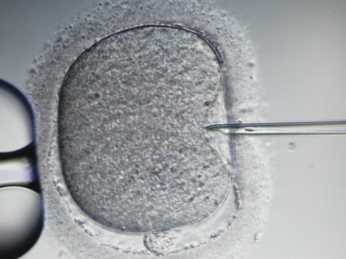 Ivf Test Could More Than Double Success Rate To Over 80 Per Cent 