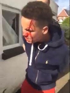 Police watchdog investigates video of 14-year-old who sustained