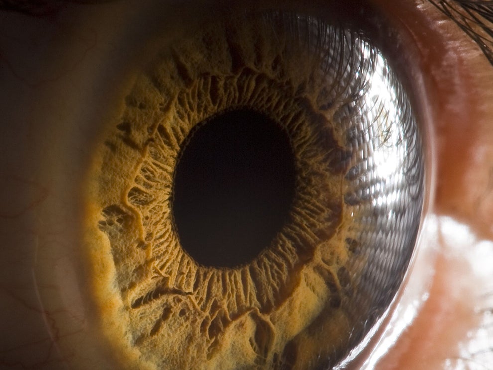 The eyefeasting parasite that can get in through your contact lens The Independent The