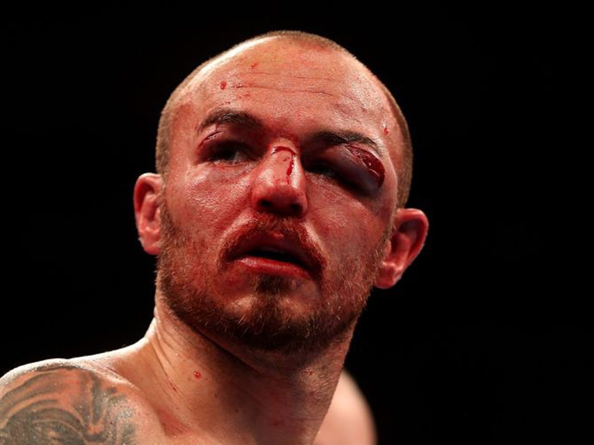 Kevin Mitchell shows the effects of his failed bid to capture the WBC World Lightweight Championship