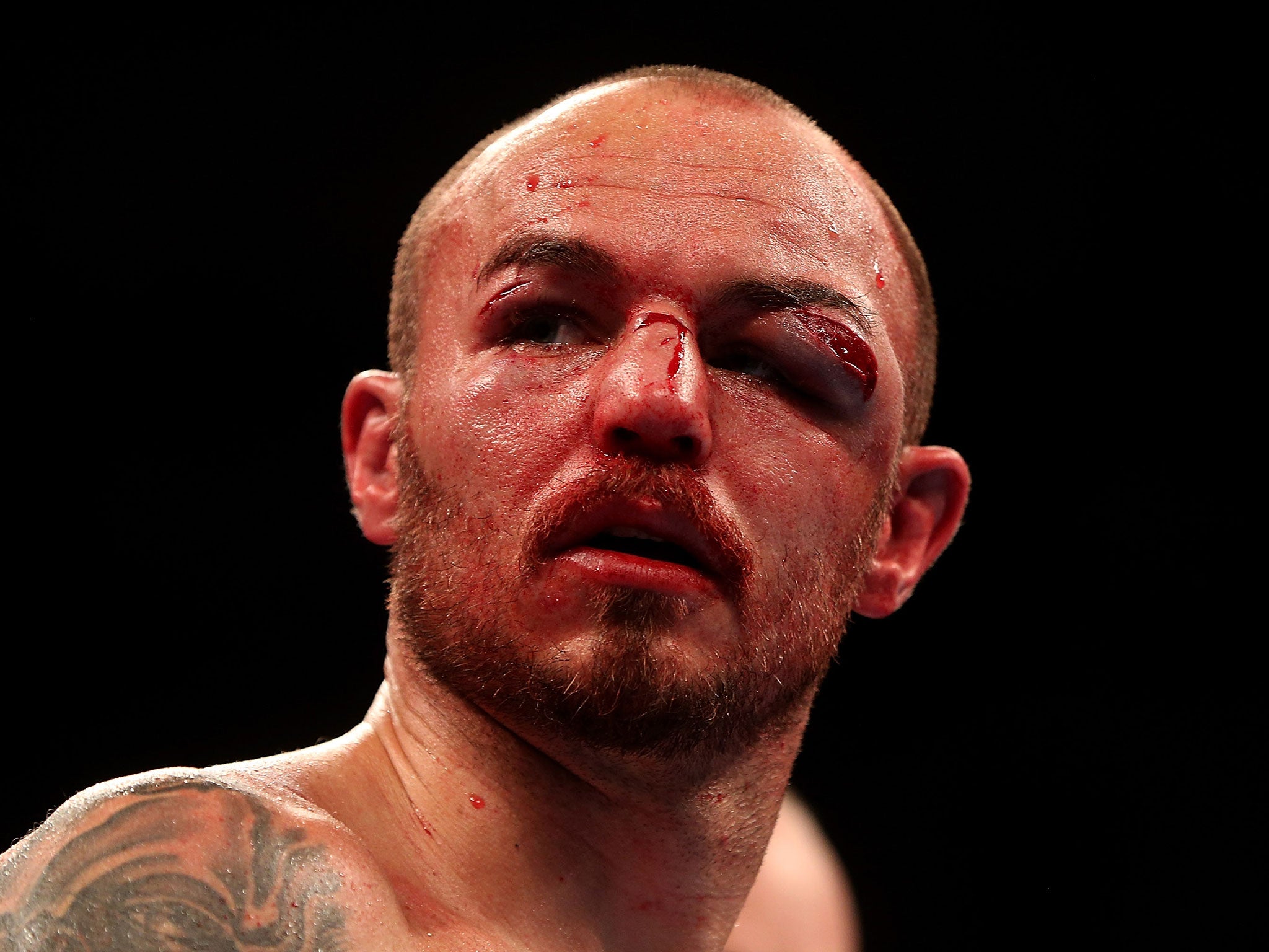 Kevin Mitchell face: London boxer puts on smile day after bruising fight at  the O2, The Independent