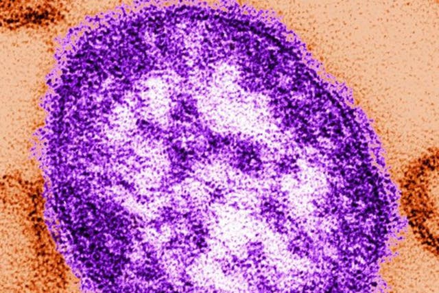 A single virus particle, or "virion," of measles