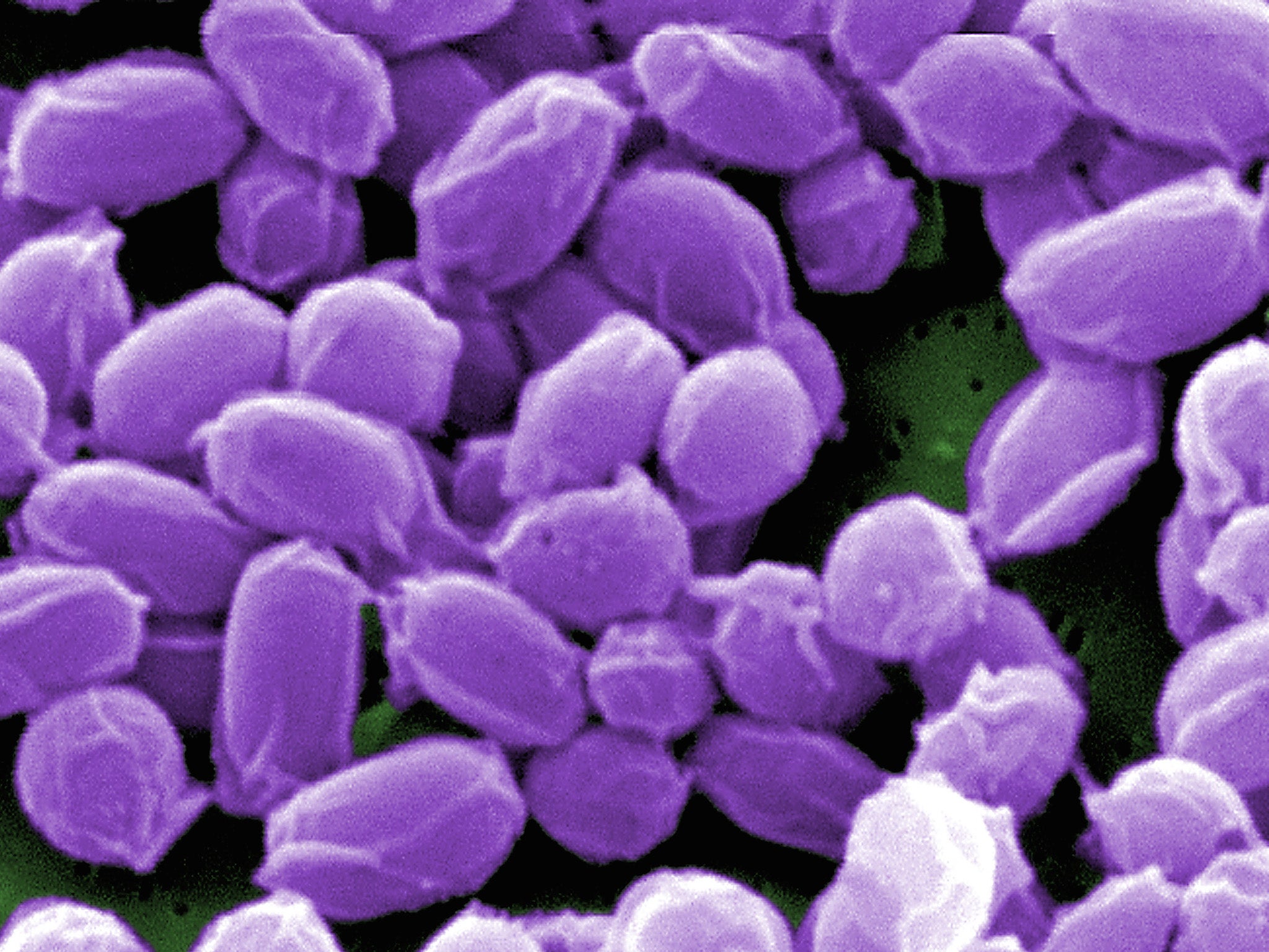 The US has admitted anthrax spores were sent to Britain as well