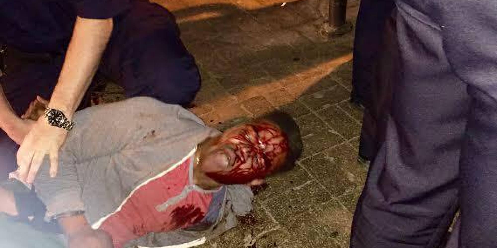 Martese Johnson's face was covered in blood following the violent arrest