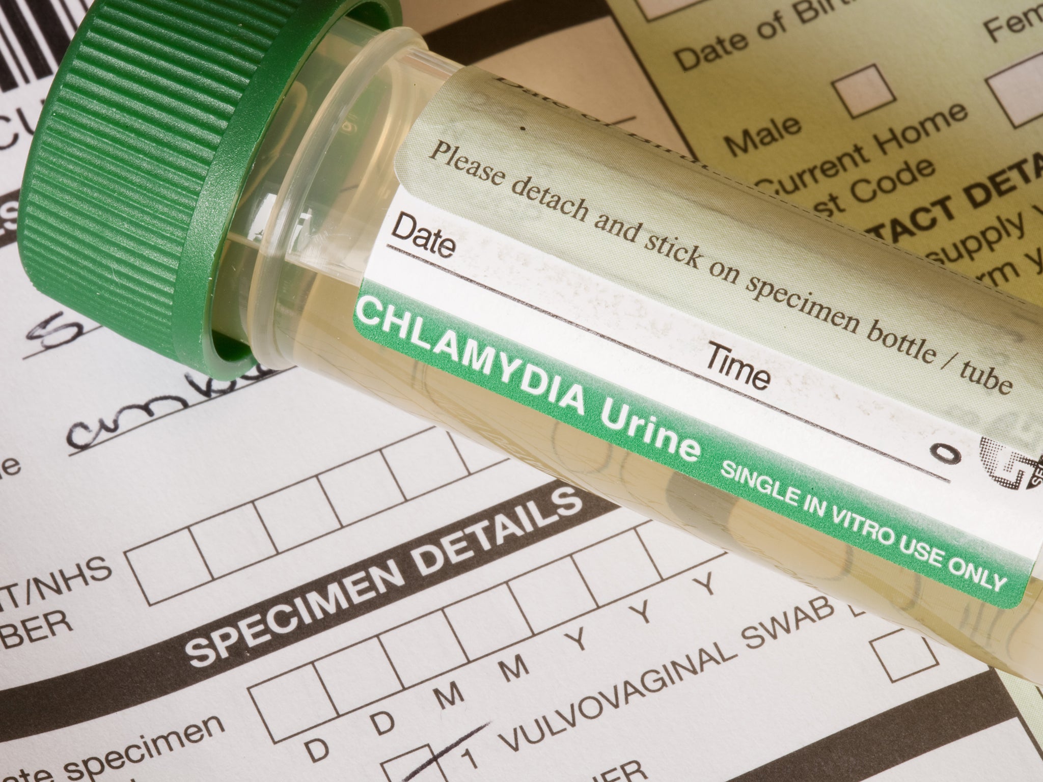 Chlamydia is extremely common. Around the world an estimated 100 million are infected each year