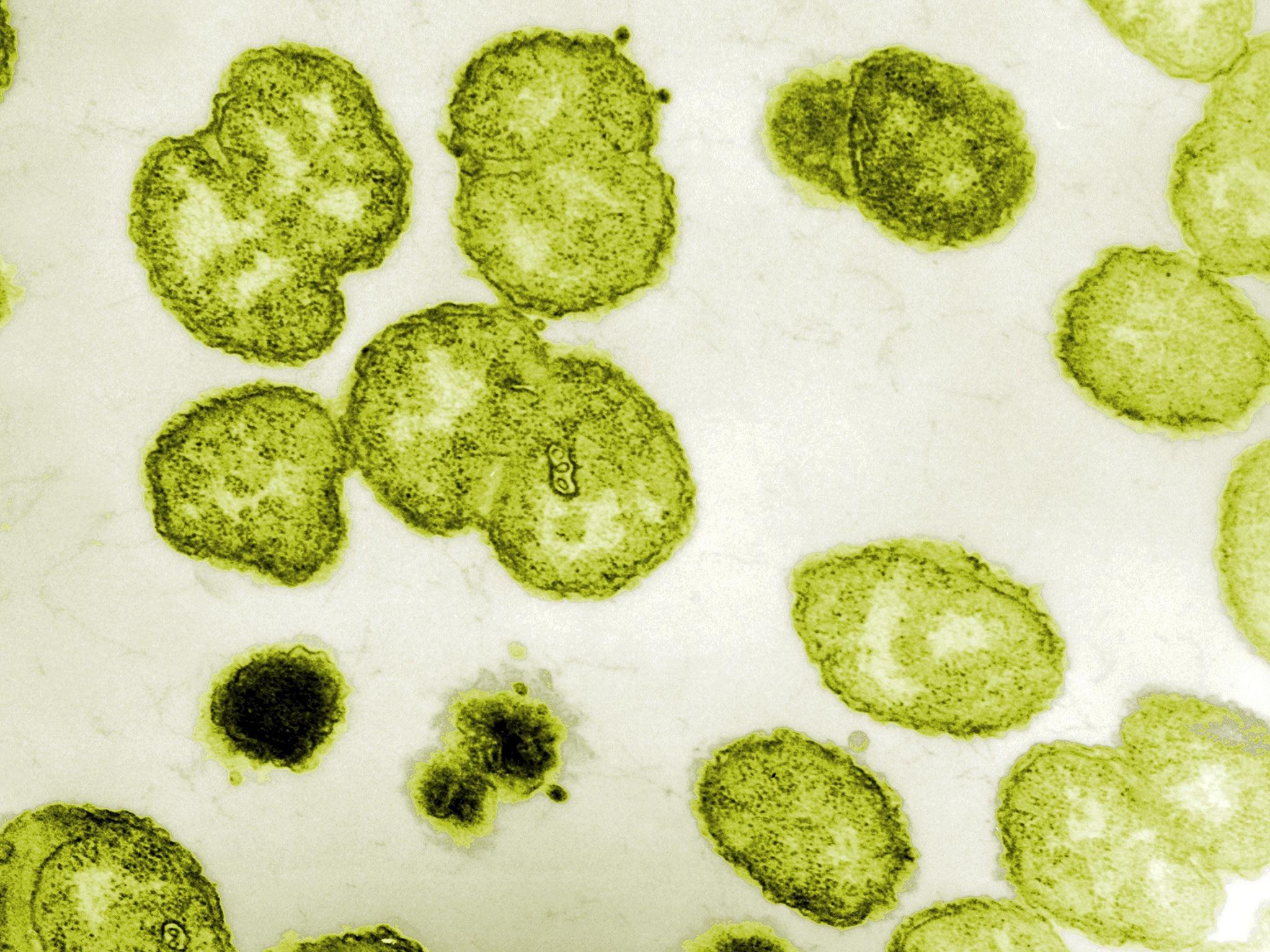 Electron micrograph of the bacterium responsible for Gonorrhea, of which there has been a 32% increase in diagnoses among gay men