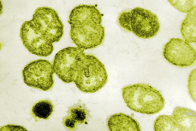 A drug-resistant strain of gonorrhea is now spreading in the UK