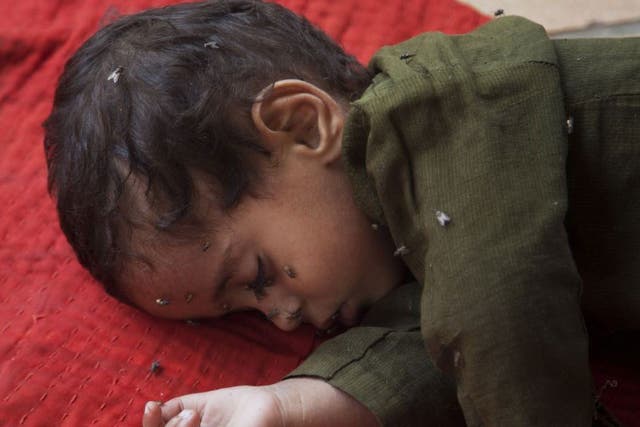 A child waiting for medical aid for suspected heatstroke at a children's hospital in Karachi