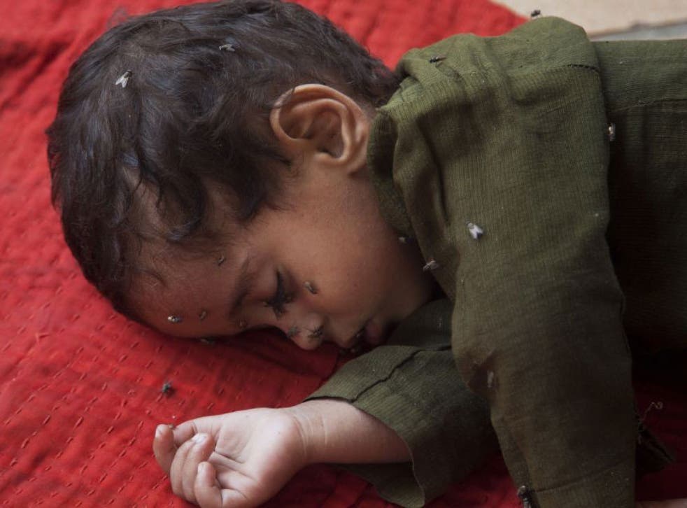 A child waiting for medical aid for suspected heatstroke at a children's hospital in Karachi 