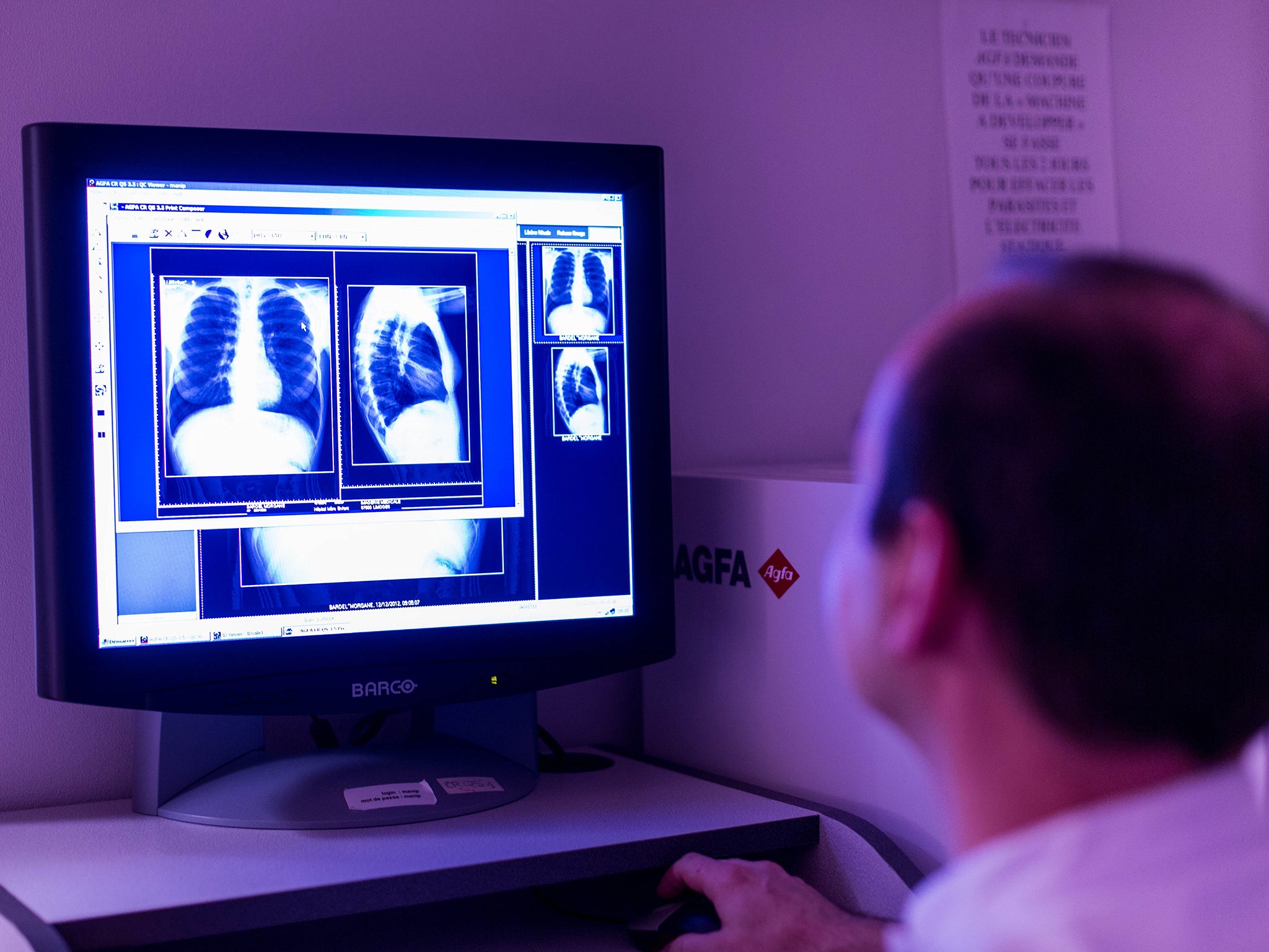 Cystic Fibrosis primarily affects the lungs